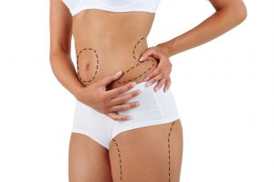 less pain and quicker recovery with liposuction hd in los angeles 